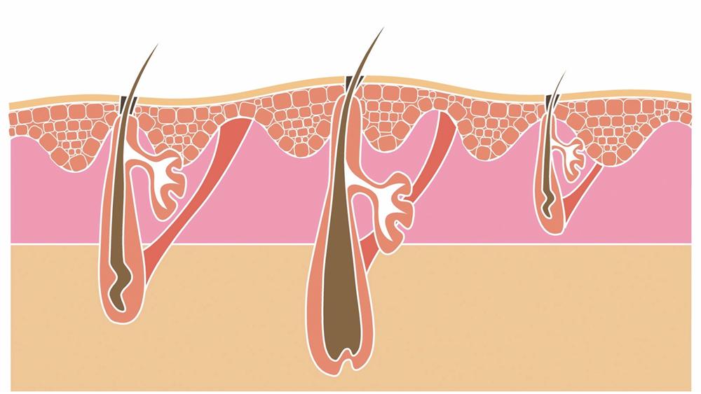 Hair Removal Pre Treatment